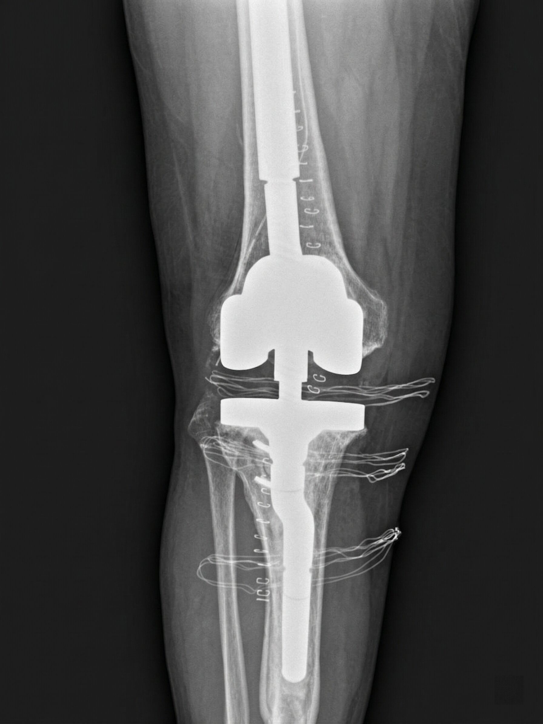 Fallimenti Meccanici: Revisione