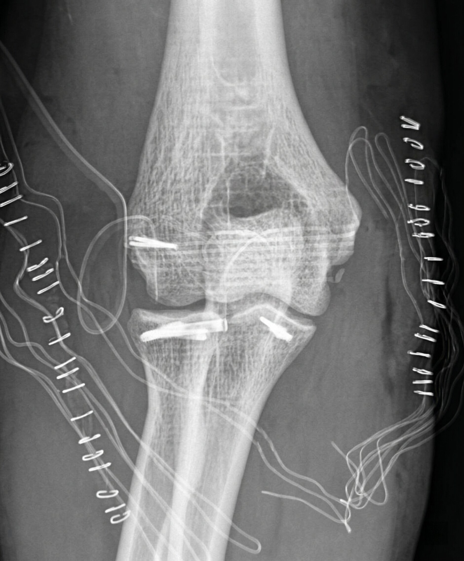 Traumatologia - immagine 1