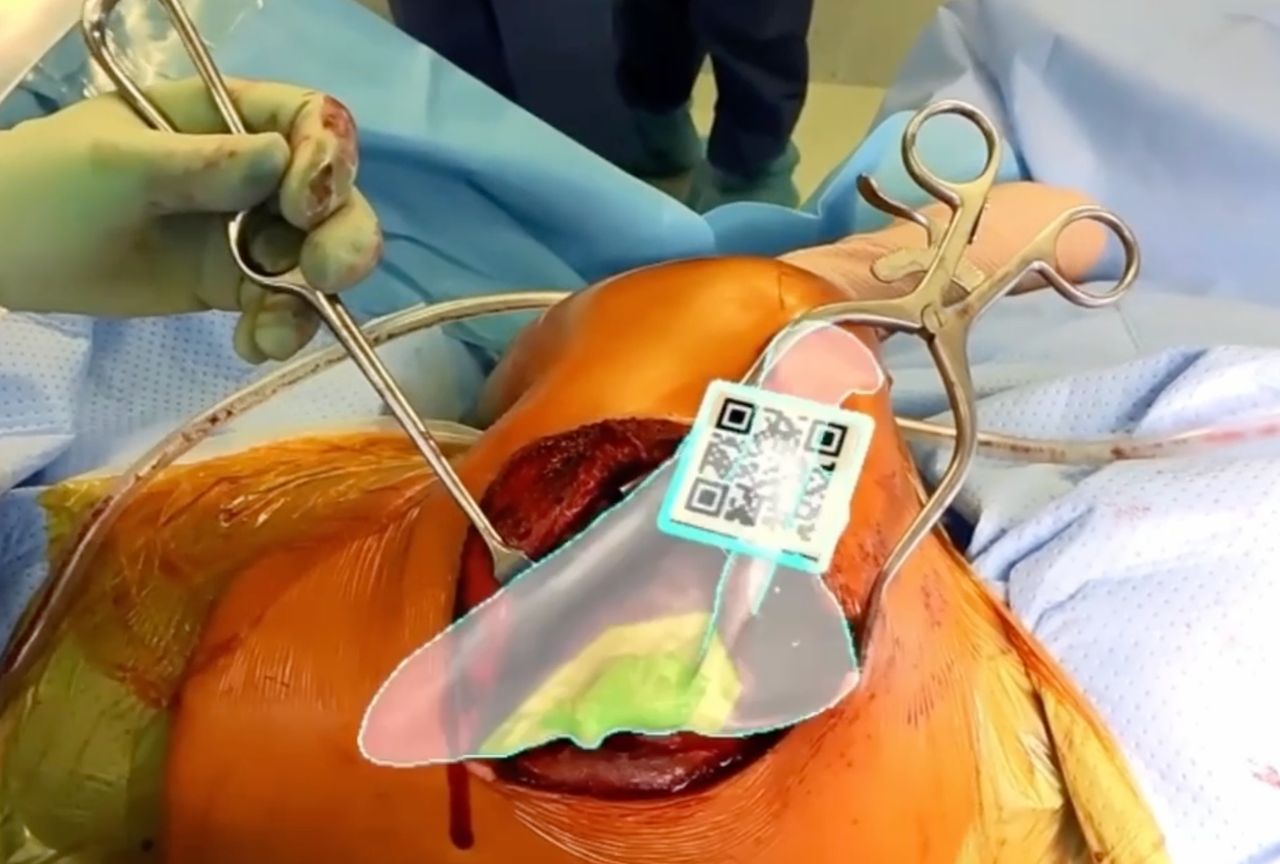 Tumori dell’Osso e Tessuti Molli